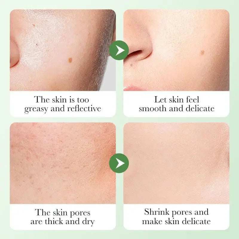 6pcs BIOAQUA Centella Skin Care Sets Moisturizing Firming Face Cream Facial Cleanser Serum Toner Skin Care Set  Products