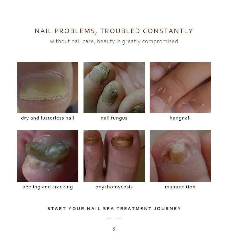 BELYN BERLY Nail Care Serum 3PCS for Nourishing Cracked Discolored Nails Repair Essence Nail Treatment Liquid